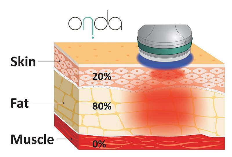 Sculpt ONDA diagram